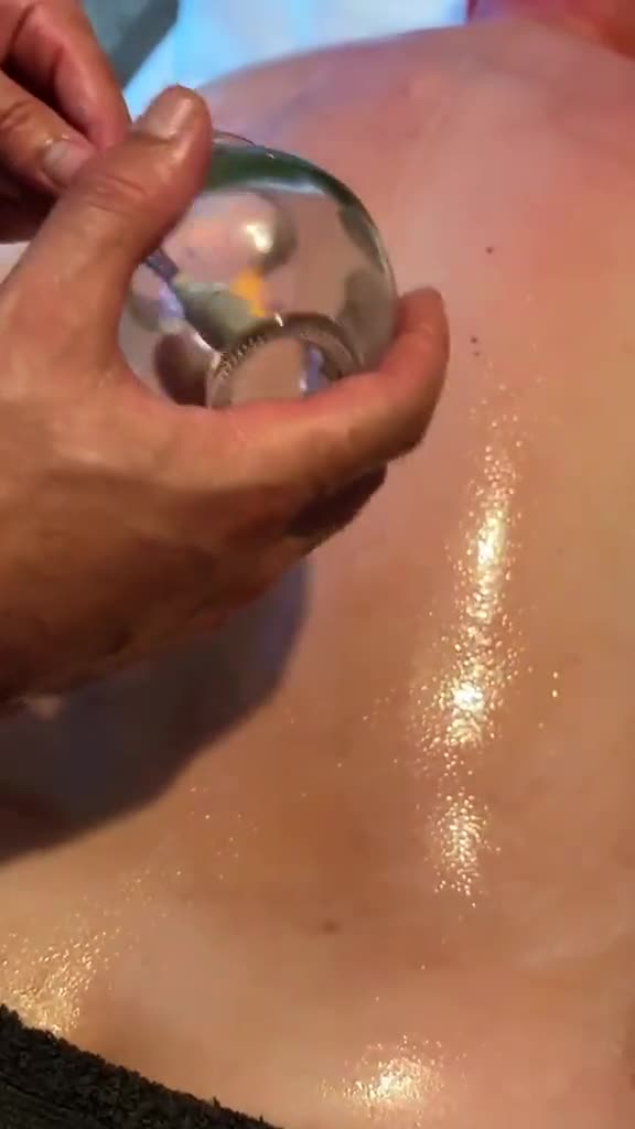Cupping glasses on an oiled back